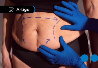 Abdominoplastia: quanto custa e opções de pagamento